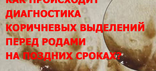 Как происходит диагностика коричневых выделений перед родами при беременности на поздних сроках